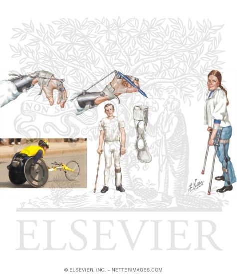 Watermarked preview of unlabeled image: Cervical Spine Injury: Rehabilitation of Patient