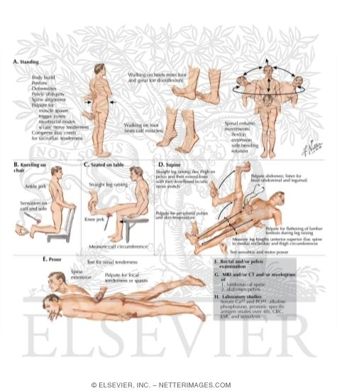 Examination of Patient with Low Back Pain