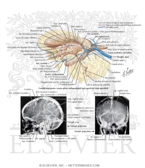 Watermarked preview of labeled image: Subependymal Veins of Brain