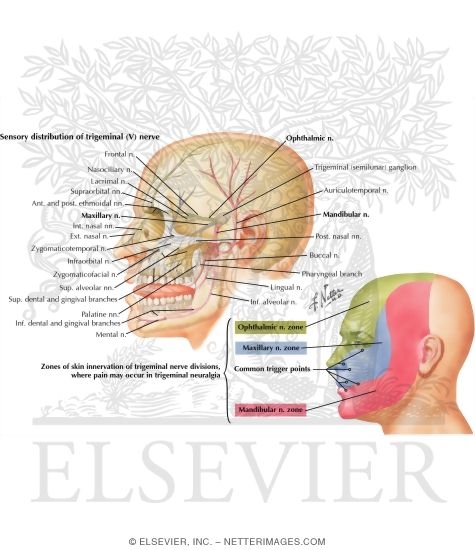 Watermarked preview of labeled image: Trigeminal Neuralgia
 