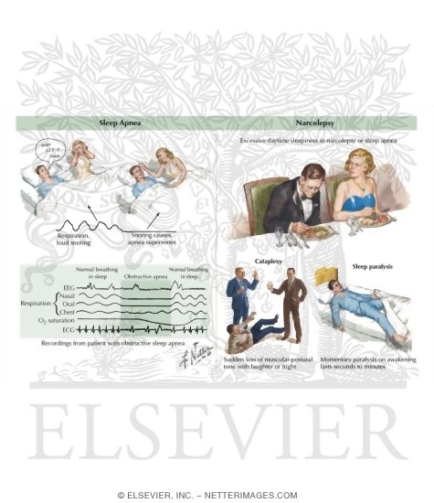 Watermarked preview of labeled image: Sleep Disorders