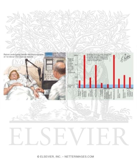 Watermarked preview of labeled image: Laboratory Studies in Neuromuscular Diseases: Electromyography and Serum Enzymes