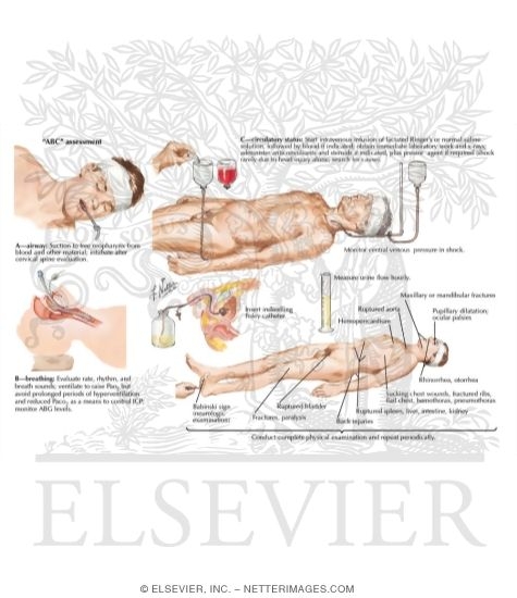 Watermarked preview of labeled image: Initial Management of Severe Head Injuries