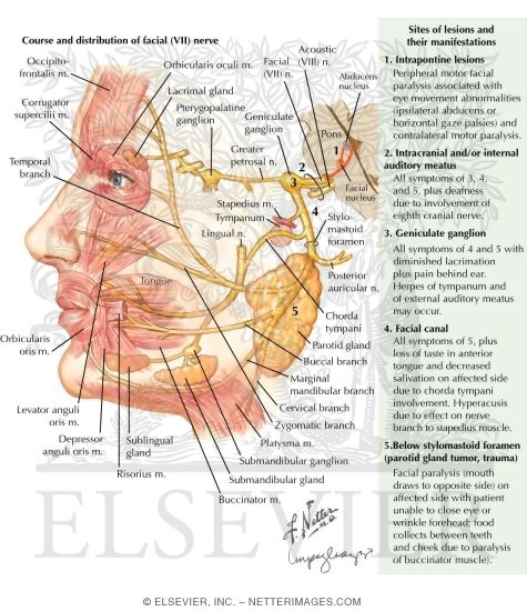 Watermarked preview of labeled image: Bell's Palsy