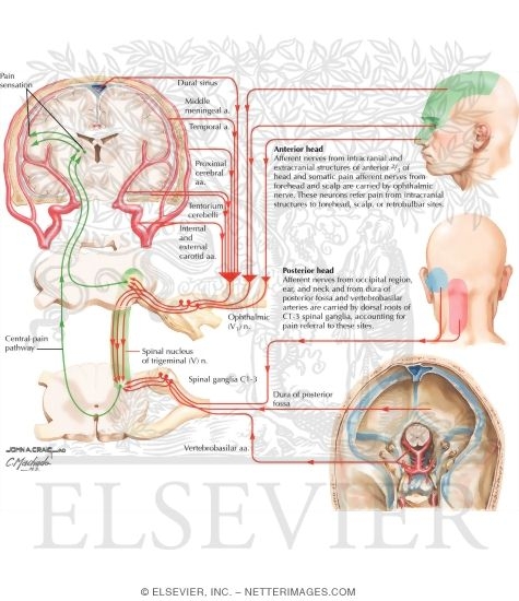Watermarked preview of labeled image: Pain: Sensitive Structures and Pain Referral