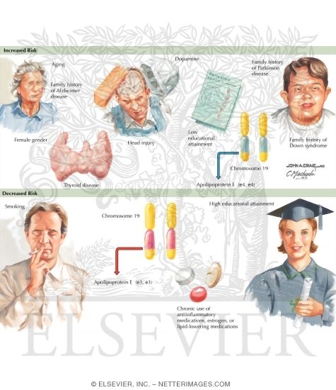 Watermarked preview of labeled image: Risk Factors for Alzheimer's Disease