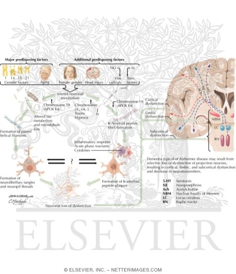 Watermarked preview of labeled image: Possible Factors in Development and Progression of Alzheimer's Disease