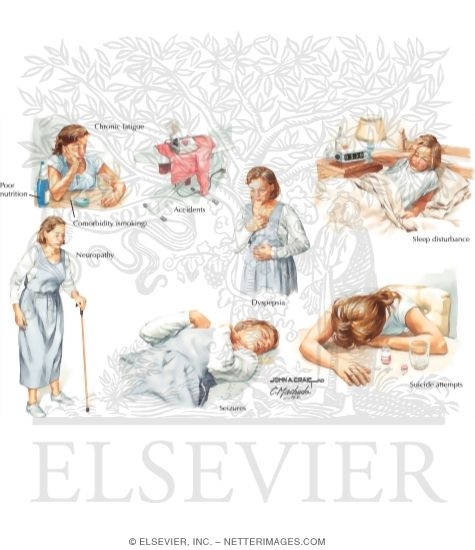 Watermarked preview of labeled image: Signs Suggestive of Alcohol Abuse