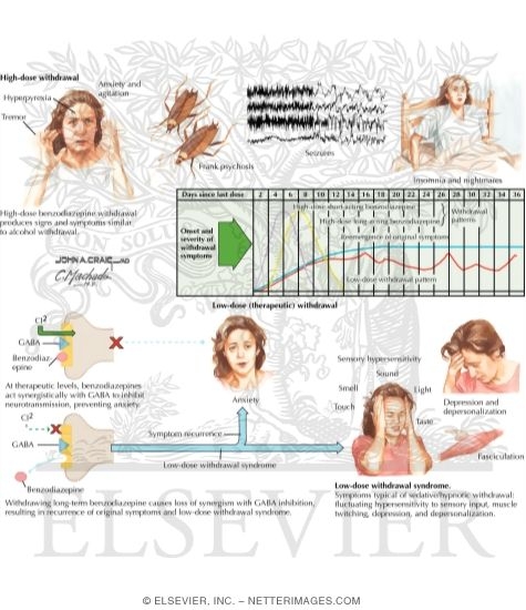Benzodiazepine Withdrawal