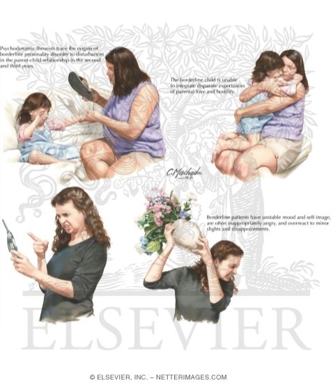 Watermarked preview of labeled image: Borderline Personality Disorder
