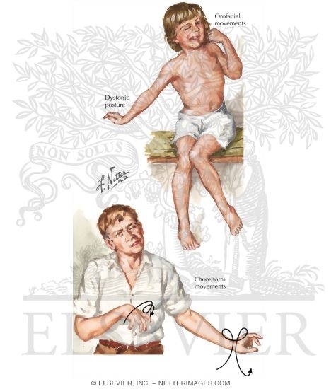 neurontin and tardive dyskinesia