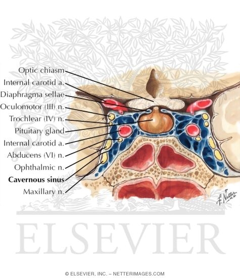 Cavernous Sinus and Its Cranial Nerves