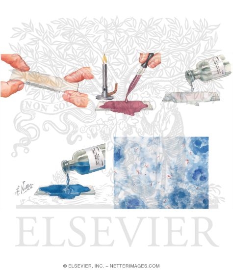 Watermarked preview of unlabeled image: Preparing Acid-Fast Bacillus Slides