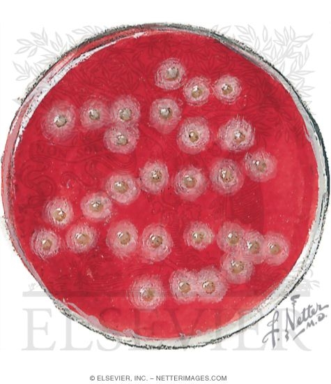 Example of Group A Streptococcus On Plate With Beta-hemolysis