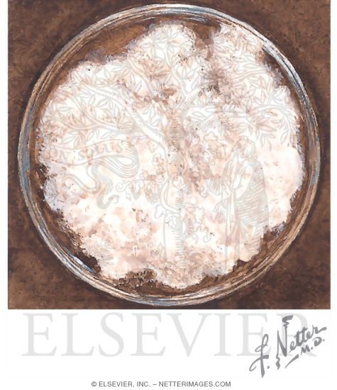 Watermarked preview of unlabeled image: Endemic Fungi Grow As Molds at Room Temperature