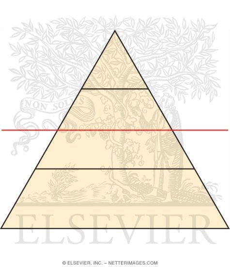 Clinical Presentation of Yellow Fever