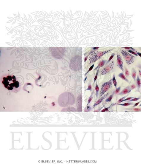Watermarked preview of unlabeled image: Trypomastigotes of Trypanosoma Cruzi In a Peripheral Blood Smear