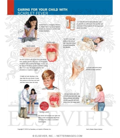 Caring for Your Child With Scarlet Fever