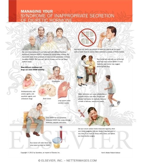 Watermarked preview of labeled image: Managing Your Syndrome of Inappropriate Secretion of Diuretic Hormone
