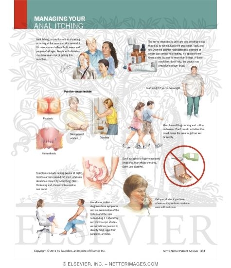 Watermarked preview of labeled image: Managing Your Anal Itching