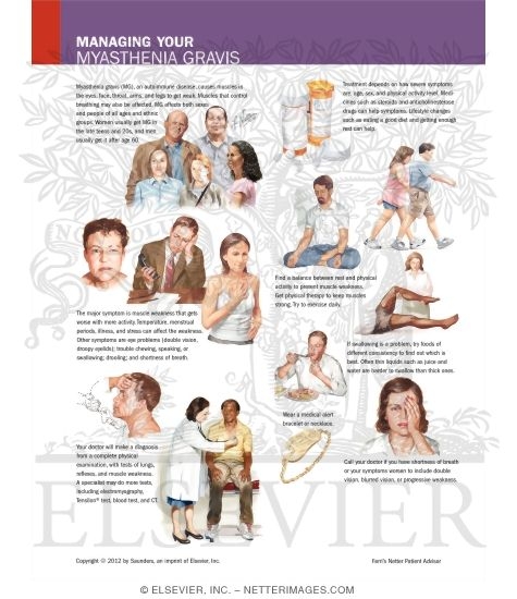 Managing Your Myasthenia Gravis