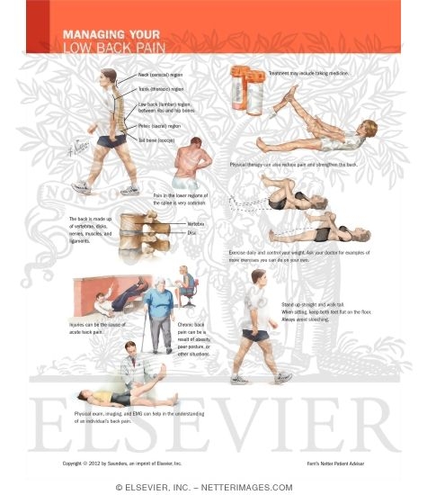 Watermarked preview of labeled image: Managing Your Low Back Pain