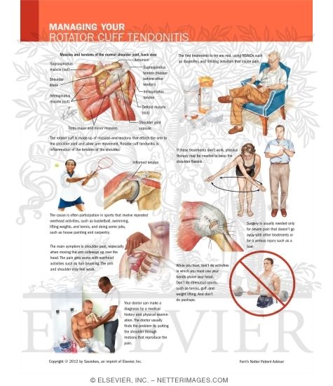 Watermarked preview of labeled image: Managing Your Rotator Cuff Tendinitis