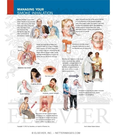 Managing Your Smoke Inhalation