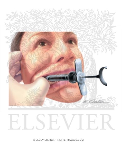 Watermarked preview of unlabeled image: Akinosi Block