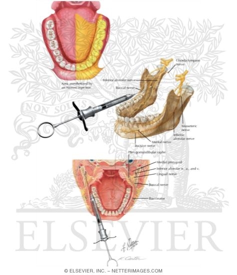 Watermarked preview of labeled image: Akinosi Block