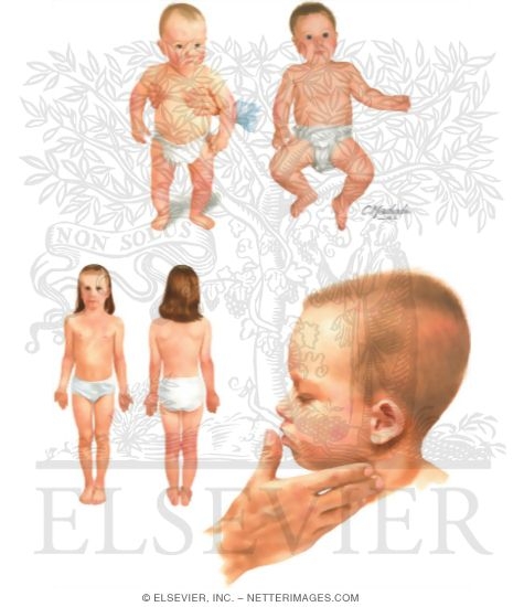 Dissertation atopic dermatitis 07 image