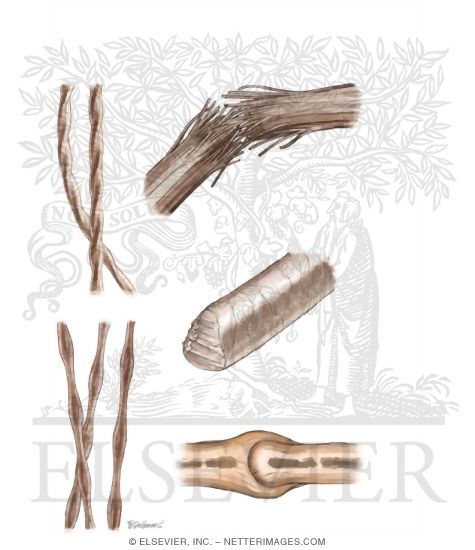 Watermarked preview of unlabeled image: Hair Shaft Abnormalities