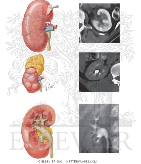 Watermarked preview of unlabeled image: Kidney: Gross Structure