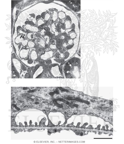 Watermarked preview of unlabeled image: Glomerulus: Electron Microscopy