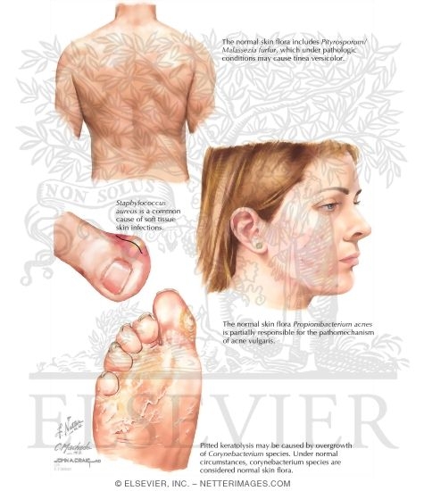 Watermarked preview of labeled image: Normal Skin Flora