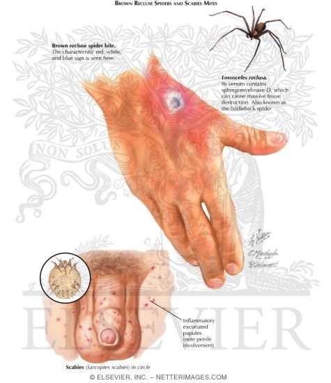 Watermarked preview of labeled image: Bug Bites