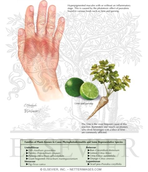 Phytophotodermatitis