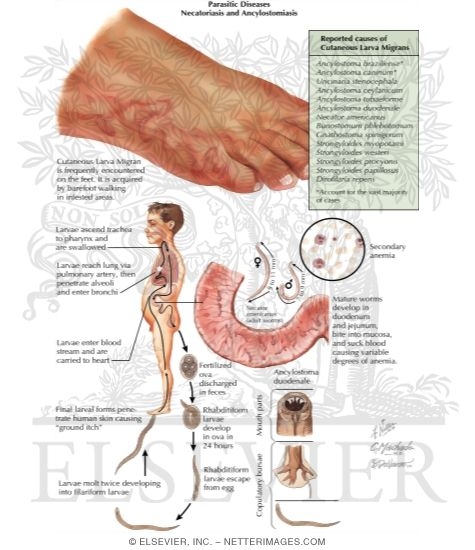 Cutaneous Larva Migrans