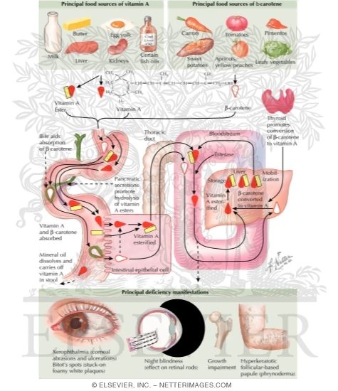 Watermarked preview of labeled image: Vitamin A Deficiency