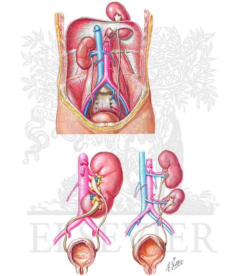 Watermarked preview of unlabeled image: Renal Ascent and Ectopia: Thoracic and Crossed Ectopic Kidney