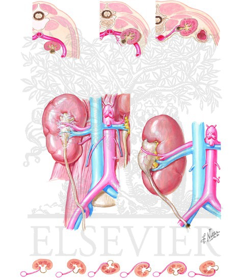 Renal Rotation and Malrotation