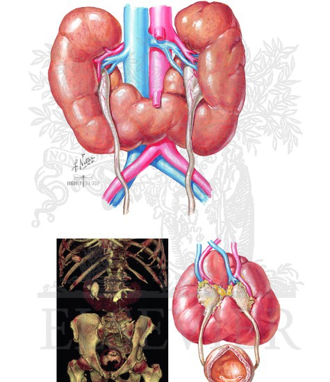 Watermarked preview of unlabeled image: Renal Fusion