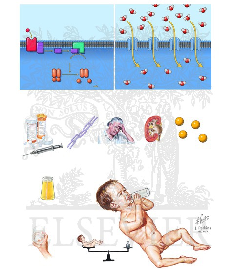 Watermarked preview of unlabeled image: Major Causes and Symptoms of Nephrogenic Diabetes Insipidus (Continued)