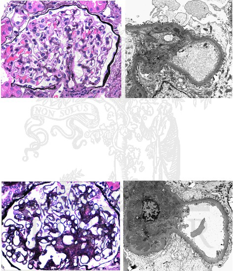 Watermarked preview of unlabeled image: Lupus Nephritis: Renal Histopathology (Classes I and II Lesions)