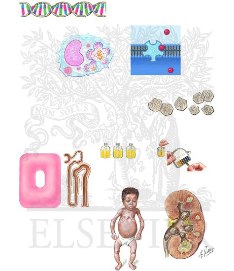 Cystinosis: Pathophysiology and the Renal Fanconi Syndrome