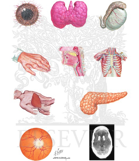 Cystinosis: Extrarenal Manifestations