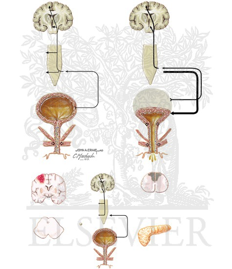 Voiding Dysfunction: Neural Control of Bladder Function and Effects of Pathologic Lesions
