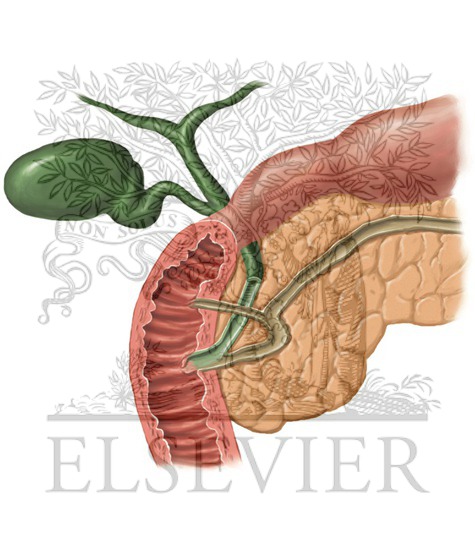 Watermarked preview of unlabeled image: Biliary System Coronal MIP 1