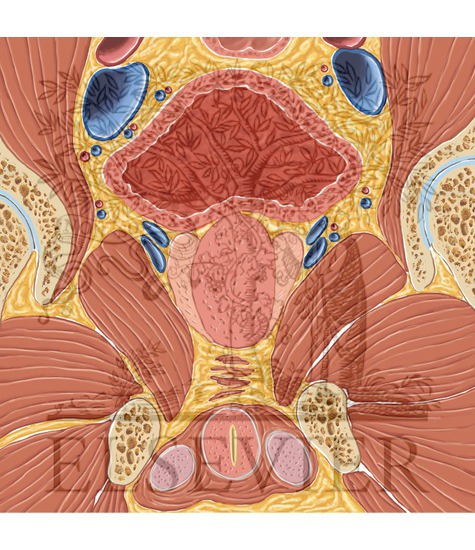 Watermarked preview of unlabeled image: Prostate and Seminal Tract Coronal 1