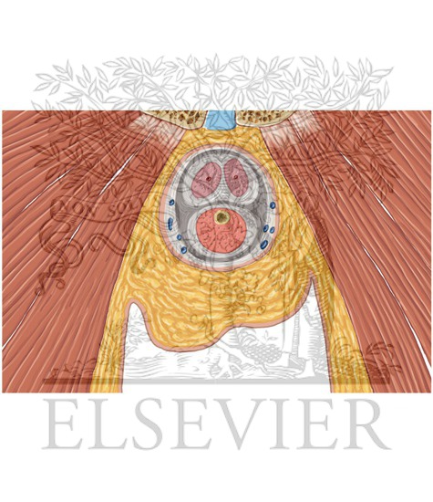 Watermarked preview of unlabeled image: Scrotum and Testes Coronal 5